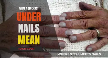 Unraveling the Mystery: What Does a Blue Cast Under Your Nails Indicate?