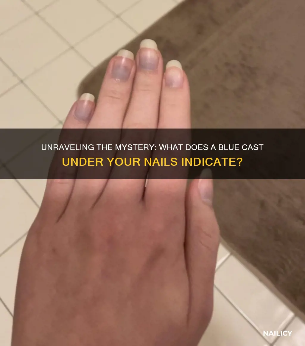 what a blue cast under nails mean