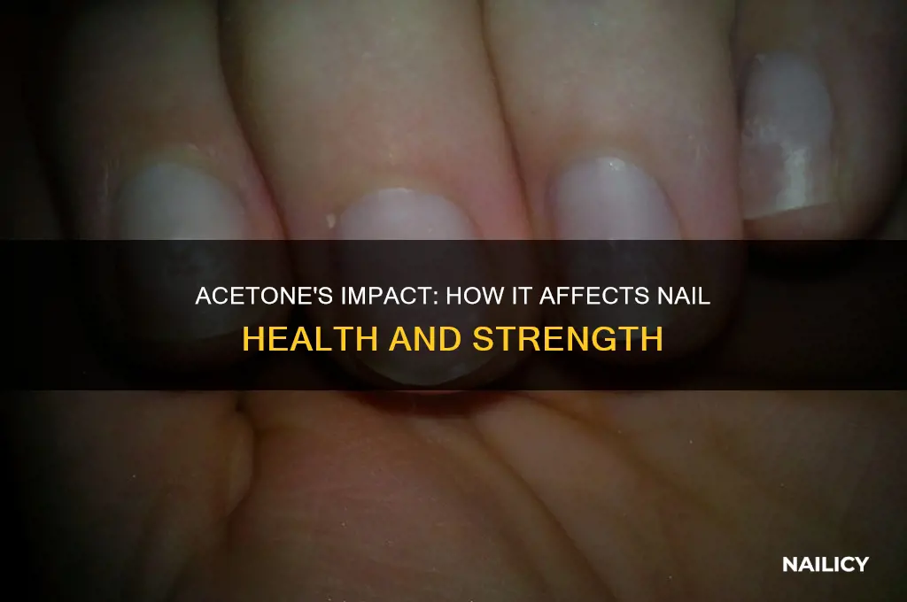what acetone does to nails
