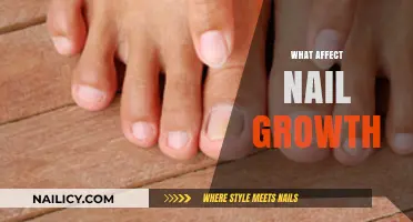Factors Influencing Nail Growth: Nutrition, Health, and Lifestyle Explained