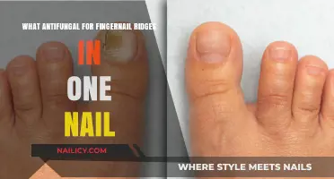 Effective Antifungal Solutions for Treating Fingernail Ridges in One Nail