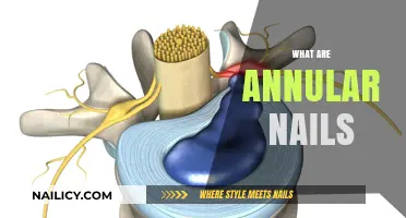 Understanding Annular Nails: Causes, Symptoms, and Treatment Options Explained