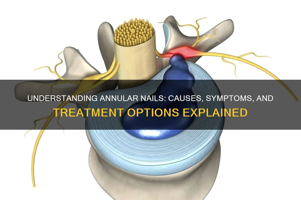what are annular nails