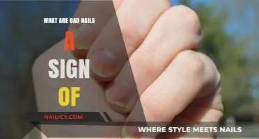 What Are Bad Nails a Sign Of? Uncovering Hidden Health Issues