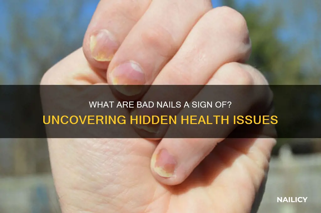 what are bad nails a sign of