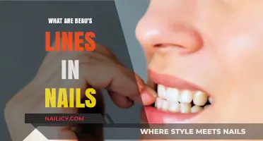 Understanding Beau's Lines: Causes, Symptoms, and Nail Health Indicators