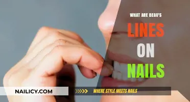 Understanding Beau's Lines: Causes, Symptoms, and Nail Health Insights