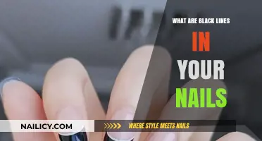 Understanding Black Lines in Your Nails: Causes and Concerns