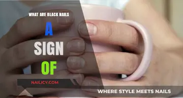 Black Nails: Uncovering Hidden Health Signs and Potential Concerns