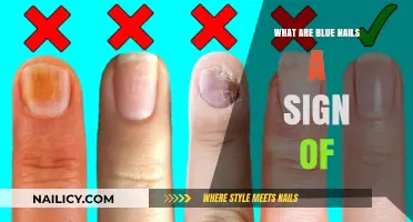 Blue Nails: Uncovering Hidden Health Issues and Their Causes