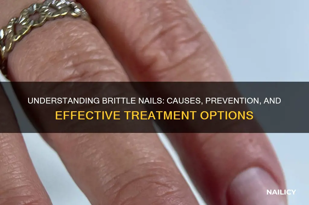 what are brittle nails from