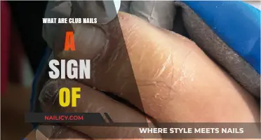 Club Nails: Uncovering Hidden Health Clues and Their Meaning
