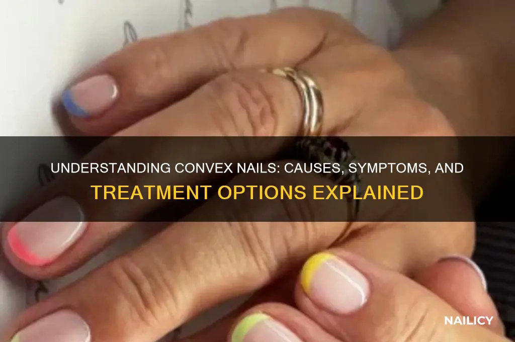what are convex nails