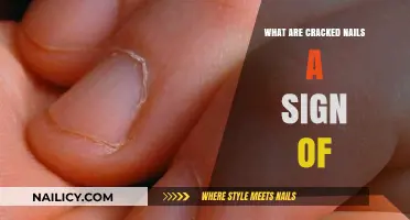 Cracked Nails: Uncovering Hidden Health Issues and Nutritional Deficiencies