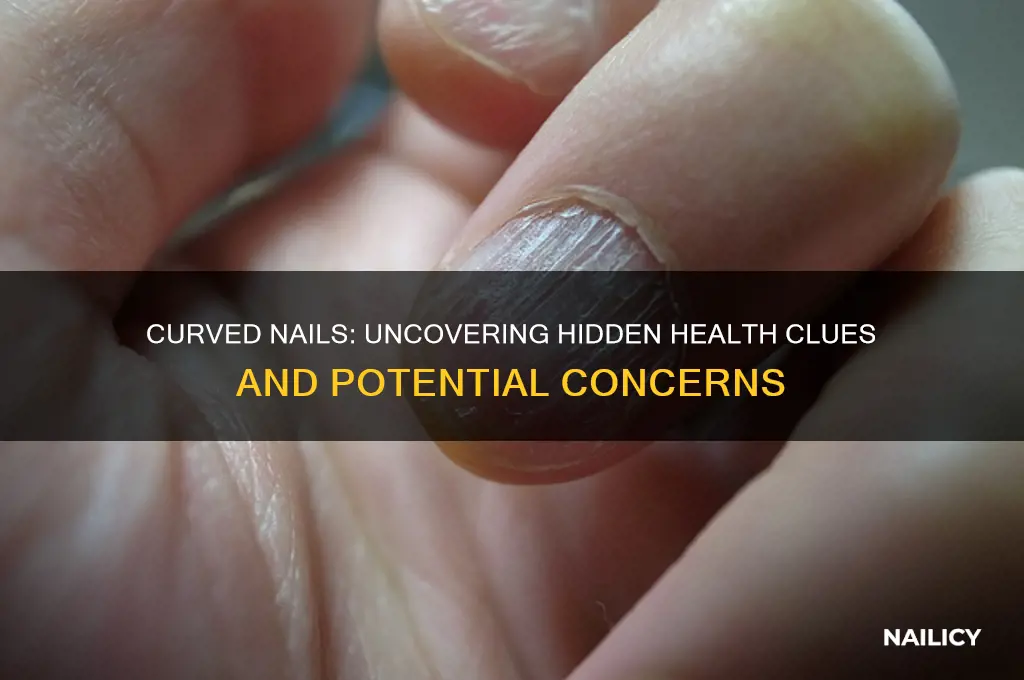what are curved nails a sign of