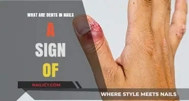 Nail Dents Decoded: Uncovering Hidden Health Signs and Causes