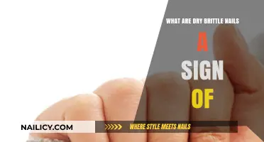 Dry Brittle Nails: Uncovering Hidden Health Issues and Nutrient Deficiencies