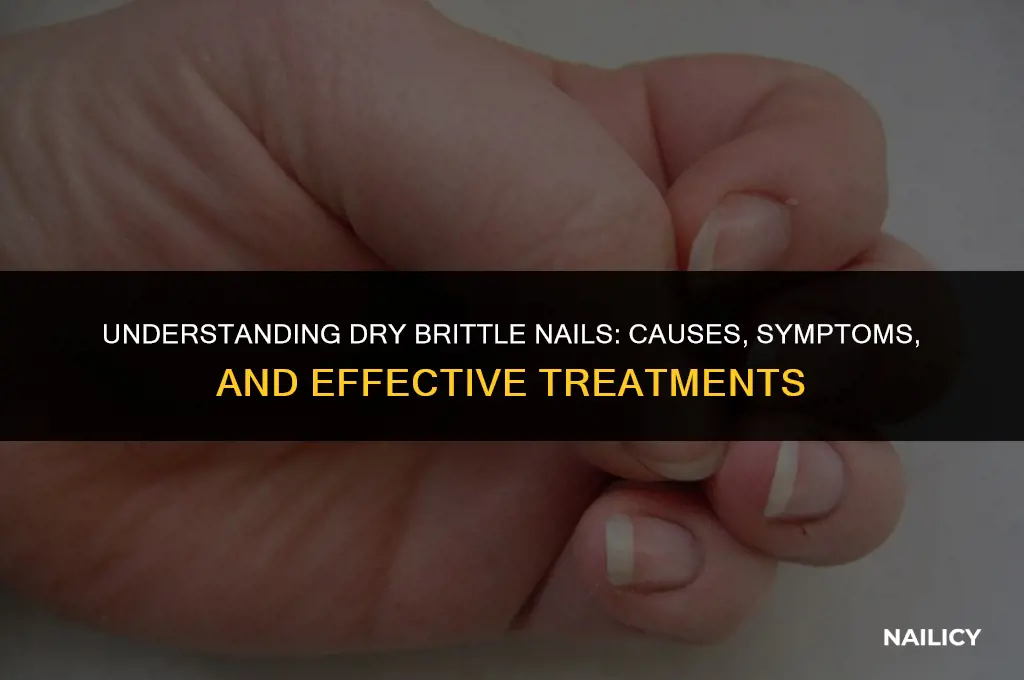 what are dry brittle nails
