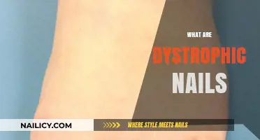 Understanding Dystrophic Nails: Causes, Symptoms, and Treatment Options