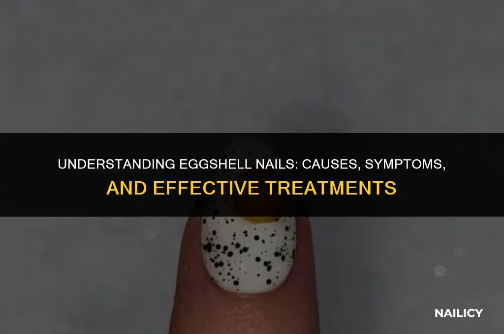 what are eggshell nails
