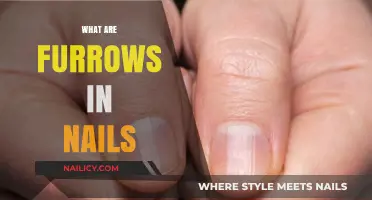 Understanding Furrows in Nails: Causes, Symptoms, and Treatments
