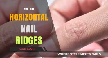 Understanding Horizontal Nail Ridges: Causes and Treatments Explained