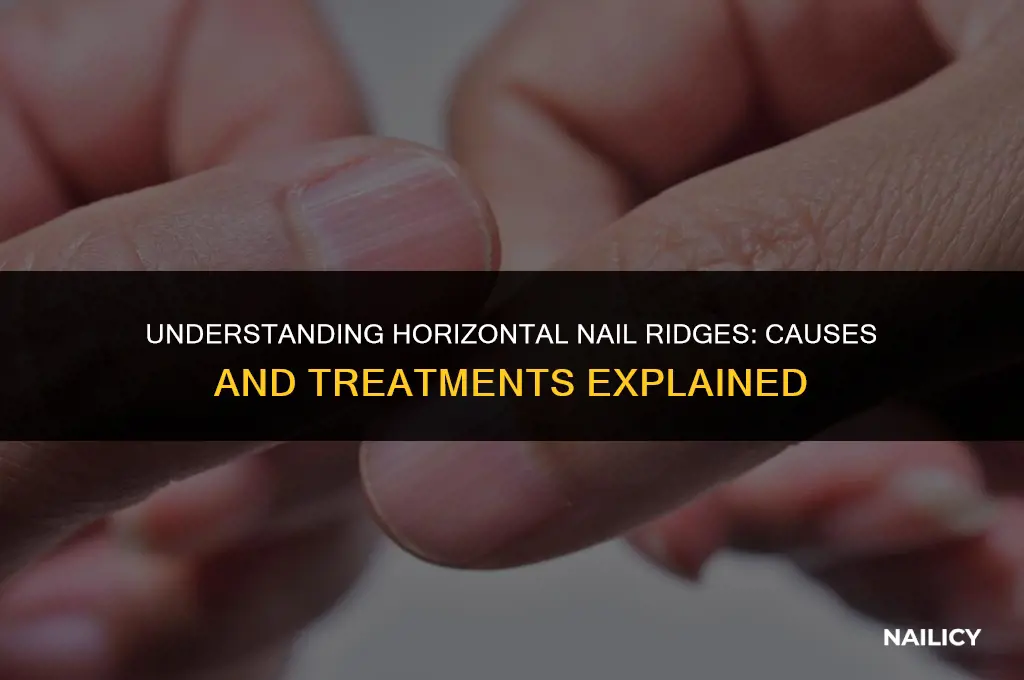 what are horizontal nail ridges