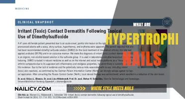 Understanding Hypertrophic Nails: Causes, Symptoms, and Treatment Options