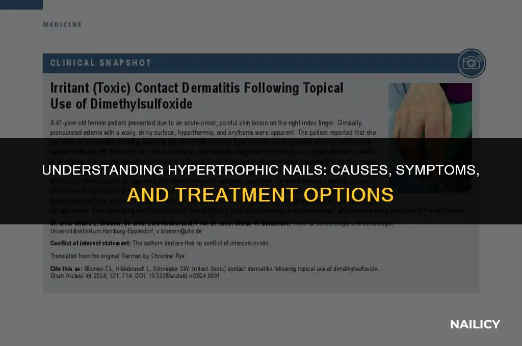 what are hypertrophic nails