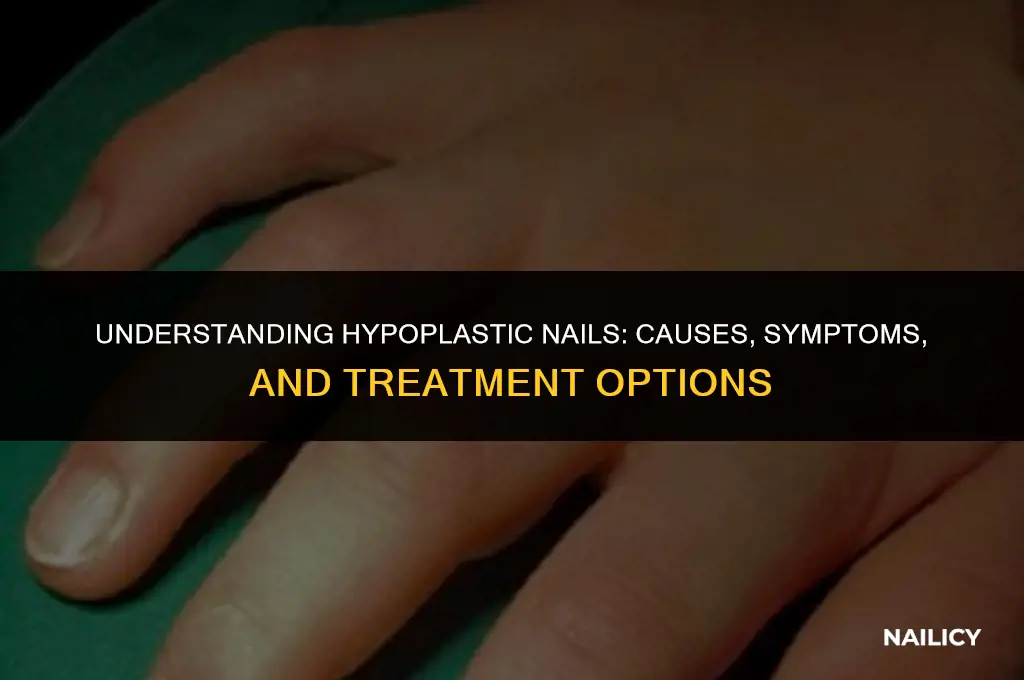 what are hypoplastic nails