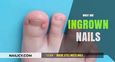 Understanding Ingrown Nails: Causes, Symptoms, and Effective Treatments