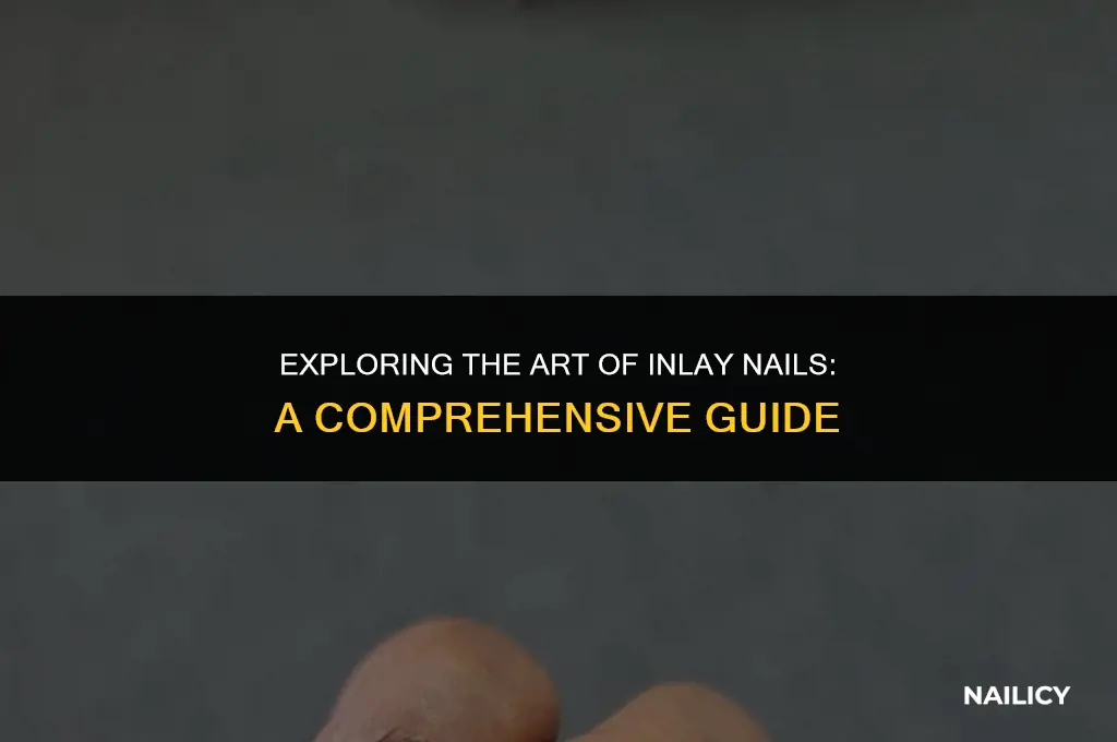 what are inlay nails