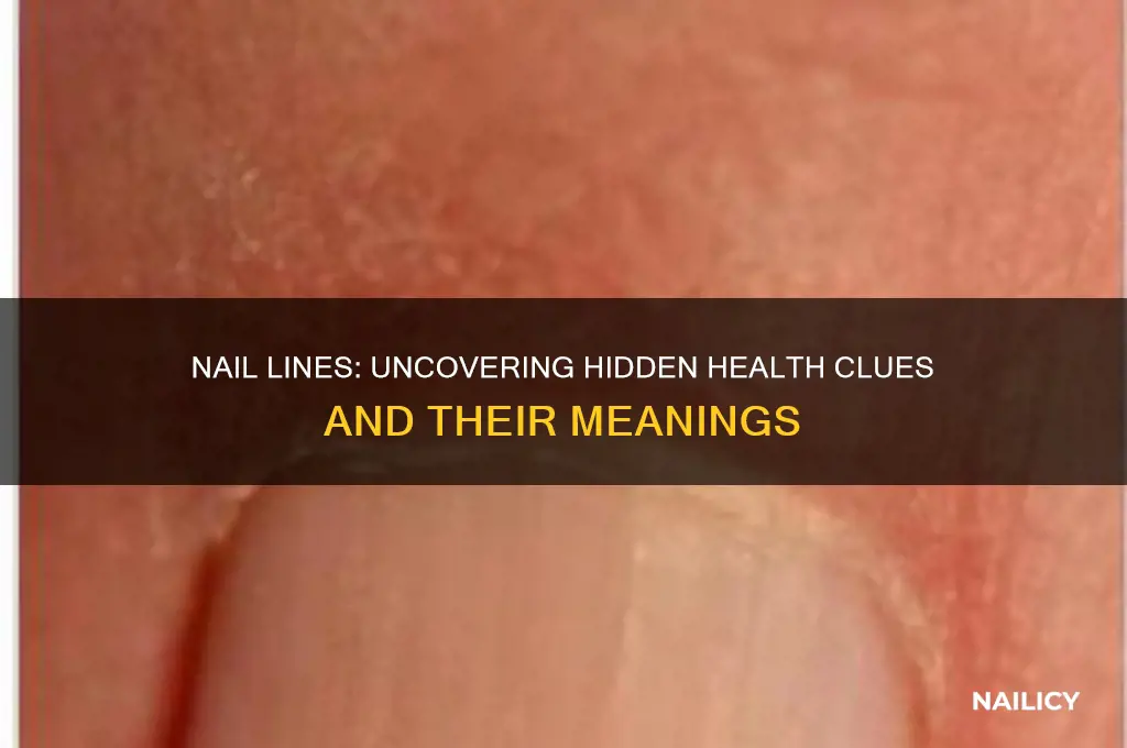 what are lines in nails a sign of