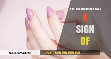 Muehrcke's Nails: Uncovering the Hidden Signs of Underlying Health Issues