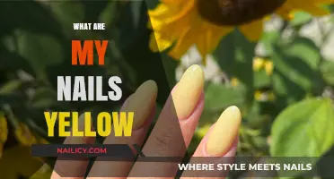 Why Are My Nails Yellow? Understanding the Causes and Solutions