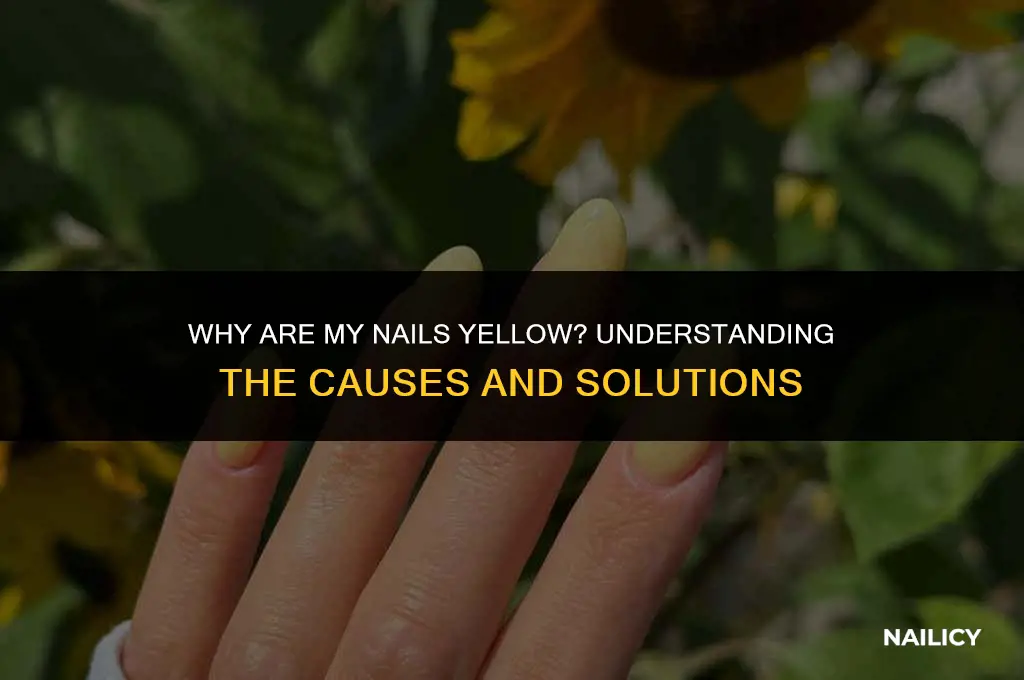 what are my nails yellow
