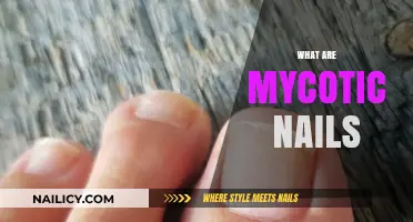 Understanding Mycotic Nails: Causes, Symptoms, and Effective Treatments