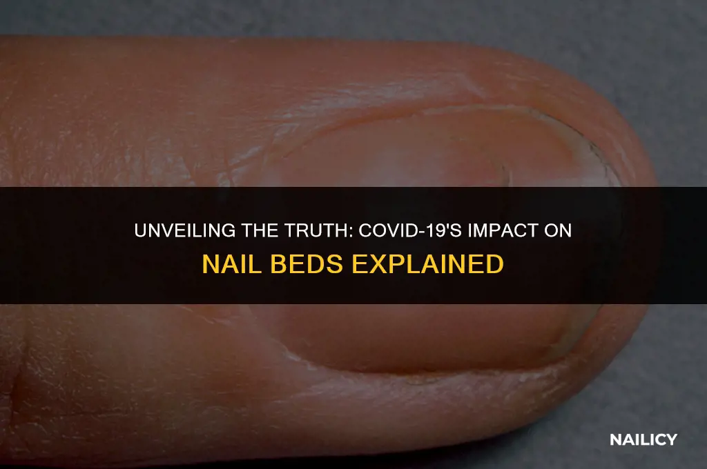 what are nail beds covid