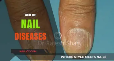 Exploring the World of Nail Diseases: Causes, Symptoms, and Treatments