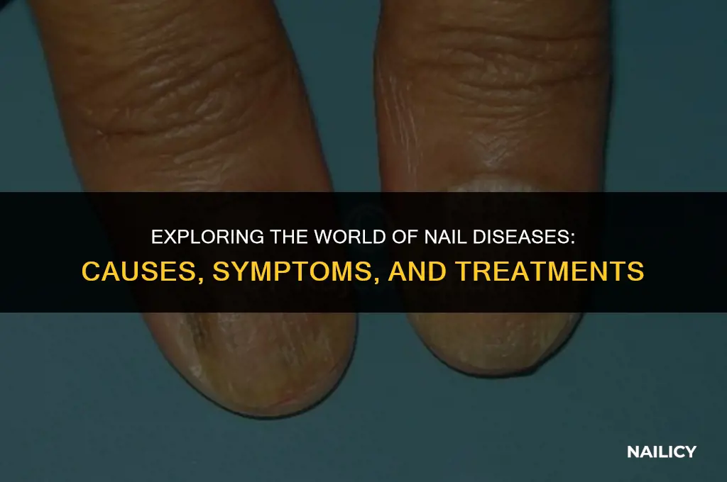 what are nail diseases