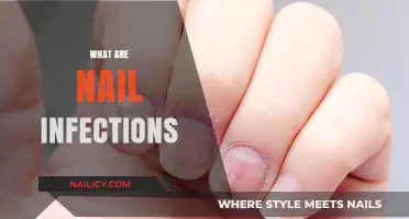 Understanding Nail Infections: Causes, Symptoms, and Effective Treatments