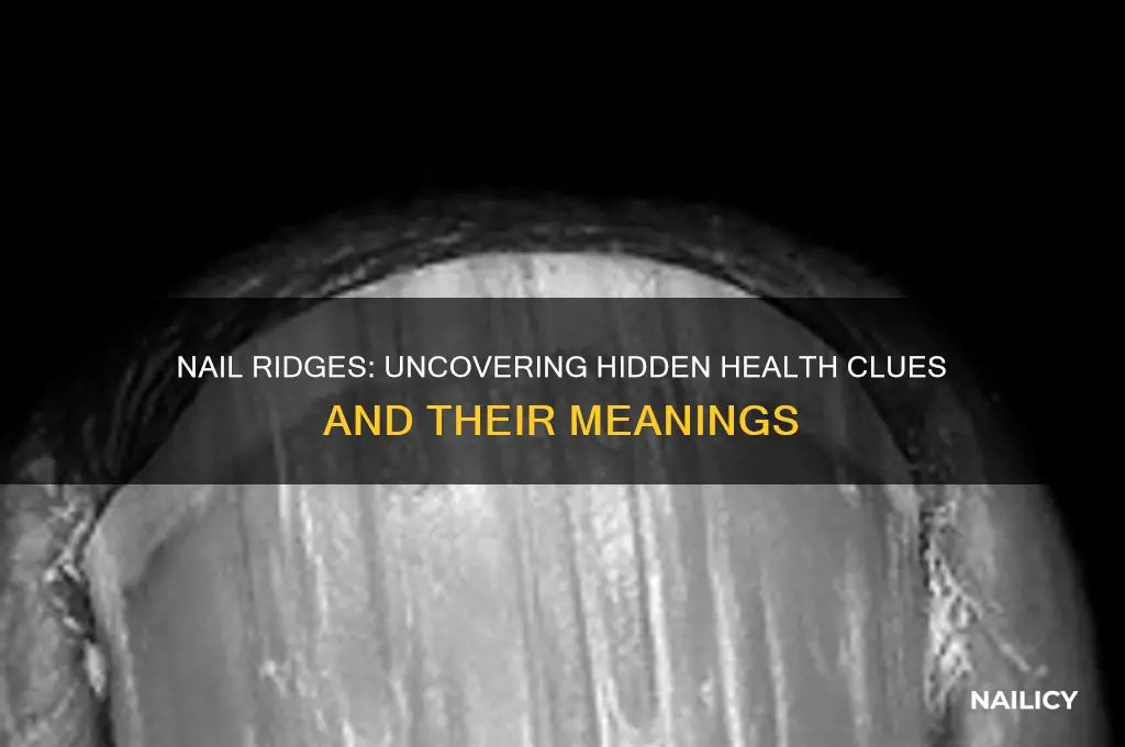 what are nail ridges a sign of