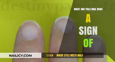 Pale Nail Beds: Uncovering Hidden Health Issues and Their Causes