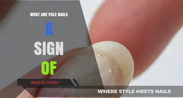 Pale Nails: Uncovering Hidden Health Issues and Their Causes