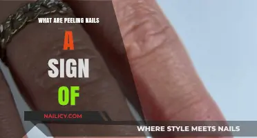 Peeling Nails: Uncovering Hidden Health Issues and Solutions