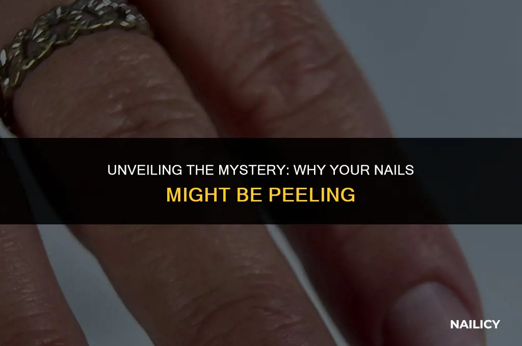 what are peeling nails