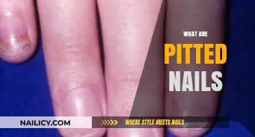 Understanding Pitted Nails: Causes, Symptoms, and Effective Treatments