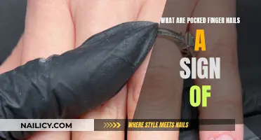 Pocked Fingernails: What Do They Mean?