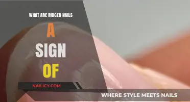 Ridged Nails: Uncovering Hidden Health Issues and Their Causes