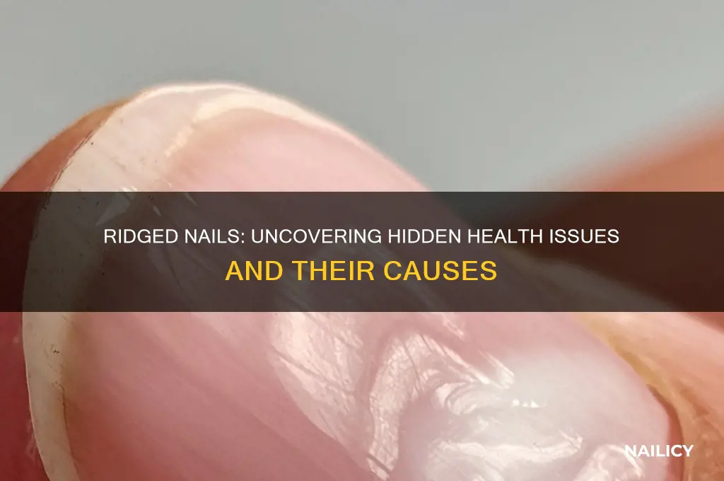 what are ridged nails a sign of